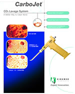 Bone Lavage System